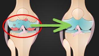 Deine Gelenke – DAS solltest du wissen! (Arthrose, Knorpel)