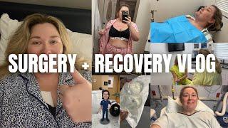 I HAD MY BREAST IMPLANTS REMOVED (+ A LIFT!) | explant & mastopexy | vlog #245