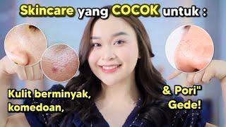 Skincare yang COCOK untuk Kulit Berminyak, Komedoan & Pori" Gede ⭐️