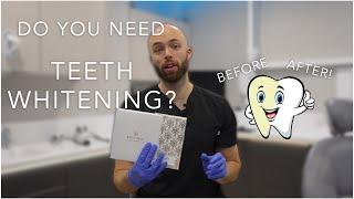 Do you need Teeth Whitening?