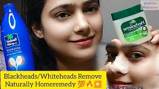 How To Remove Blackheads/Whiteheads From Nose & Face At Home #beatytips#viral#skincare #blackheads