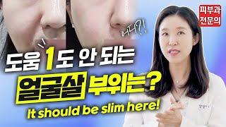 (*ENG/CHN/JP)  얼굴 이 부위에 살 많은 분들 제발 보세요! It should be slim here! - 피부과전문의 [닥터필러]