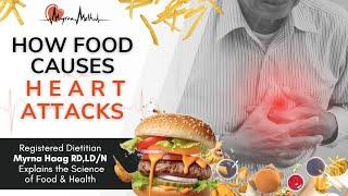 How food causes heart attacks _Live Lecture by Registered Dietitian Myrna Haag RD,LD/N