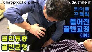허리 골반 통증, 골반균형- 카이로프랙틱 틀어진 골반교정 IN- chiropractic pelvic adjustment