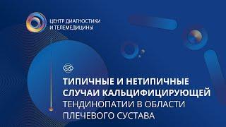 Типичные и нетипичные случаи кальцифицирующей тендинопатии в области плечевого сустава