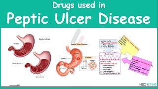 Drugs Used in Treament of Peptic Ulcer Diseae Pharmacology