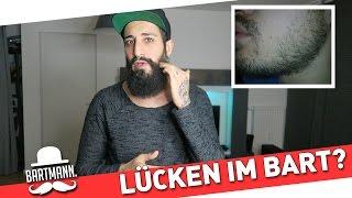 Lücken im Bart - Was tun?| BARTMANN