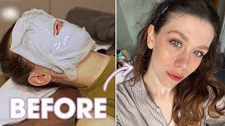 I Got the MOST POPULAR Skincare Treatment in Korea *RESULTS*