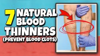 7 Natural Blood Thinning Foods & Drinks to Prevent Blood Clots | Natural Blood Thinner at Home