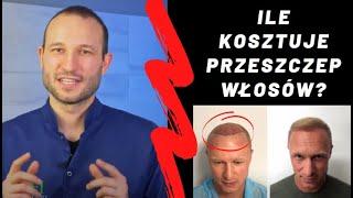 Ile kosztuje przeszczep włosów? [Dlaczego skąpy dwa razy traci] Cena przeszczepu włosów