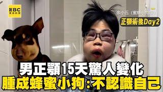 男正顎15天驚人變化！腫成蜂蜜小狗：快不認識自己@cosmosviral