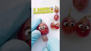 5 BABIES and Conjoined Twins️ Grape Vacuumbirth (No c-section) #fruitsurgery #shorts #cute #food