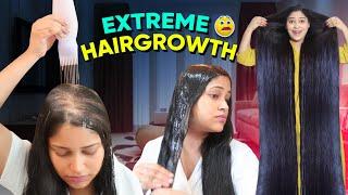 I Applied only Few Drops of this Diy & Got Triple Hairgrowth गंजेपन से तुरंत बचना है तो ये लगा लो