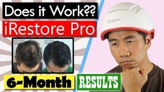 Do LLLT Laser Hair Restoration Helmets Work? iRestore Pro Review Ep. 4: 6-month Results!