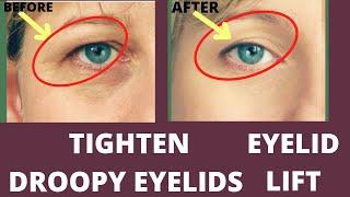 LIFT DROOPY EYELIDS + FACE YOGA AND MASSAGE