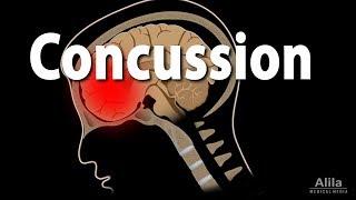 Concussion: Pathophysiology, Causes, Symptoms and Treatment, Animation