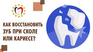 Восстановление зуба при сколе композитными материалами, винирами.  Скол зуба восстановление. 12+