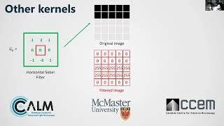 Image Processing Tutorial: Session 2- Filtering, segmentation, particle counting, basic measurements