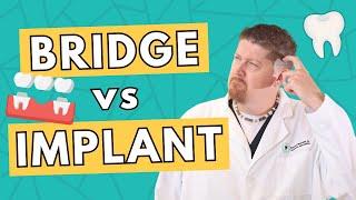 Dental Bridge vs Dental Implant | Costs, Pros and Cons, Which to Choose?