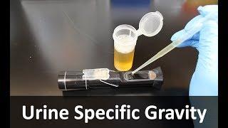 Urine Specific Gravity Refractometer