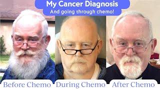 Cancer Patient Story: My 1st Symptoms, Tests & Diagnosis (Blood Cancer) | Bill (1 of 4)