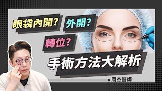 眼袋內開or外開？該選擇哪種眼袋手術？如何避免外翻後遺症｜周杰醫師