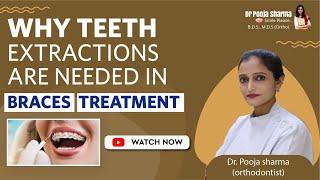 Why Teeth Extractions are Needed In Braces Treatment? Complete Surgery in Agra - Dr Pooja Sharma