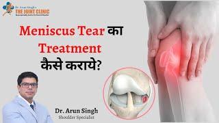 Meniscus tear का Treatment कैसे कराये | Treatment of meniscal tear | Dr Arun Singh