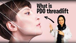 What is PDO threadlift | Non-surgical Face lift with PDO threads |All about Threadlift procedure