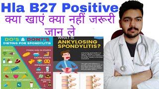 hla b27 positive patient kya khaye kya na khaye | Ankylosing spondylitis diet plan | hla-b27 diet