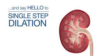 Kidney Stone Removal Animation - Infuse Medical