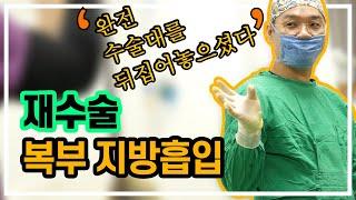 복부 지방흡입 재수술 / 유착 때문에 재수술이 안 된다고요? / 하고 싶어도 못하는 것이 장천공?