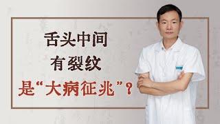 舌头中间有裂纹，是“大病征兆”？