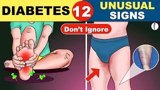 12 Unusual Symptoms of Diabetes | Diabetes Symptoms | Diabetes Mellitus |  | Diabetes Warning Signs