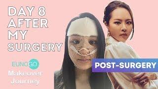 [Eunogo Makeover Tour] 8 days after Sophia's Korean cosmetic surgery makeover with Eunogo