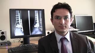 Ankle Fracture Surgery - Munjed Al Muderis discusses.