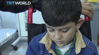 The War in Syria: Turkish prosthetic clinic helps Syrian kids