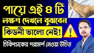 পায়ের এই ৪ টি লক্ষণ দেখলে বুঝবেন - কিডনি বিপদে আছেকিডনি খারাপের লক্ষণ কি