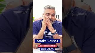 Stroke Causes: Risk Factors, Symptoms, and Prevention with Dr. Naresh Bhati #strokecare #shorts