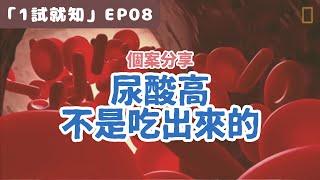 尿酸高不是吃出來的！《1試就知》第8集