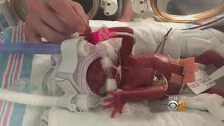 Moms Rally To Aid Mother Of Premature Baby