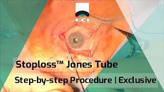 StopLoss™ Jones tube | CDCR | Step-by-step Procedure | Exclusive | FCI Lacrimal