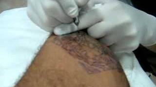 Tattoo-ing