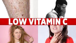 8 Signs of a Vitamin C Deficiency You've Never Heard About