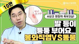 발등이 퉁퉁 부어요...봉와직염 VS 통풍 차이는? #SNU서울병원 #서상교