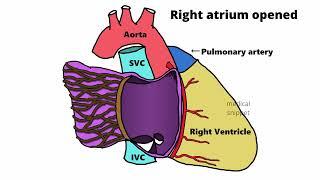 Anatomy of Right Atrium (Cardiac Morphology: Chapter 1)