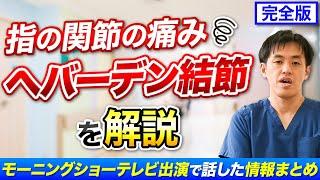 【完全版】指の関節の痛み へバーデン結節を解説　テレビ番組で話した内容のまとめ