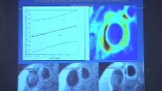 Molecular Imaging of Vascular Disease