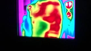 mandys face in heat vision