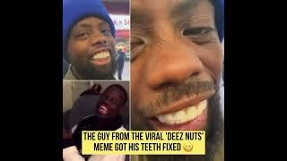 #Deeznuts #viralguy teeth got fixed #shorts